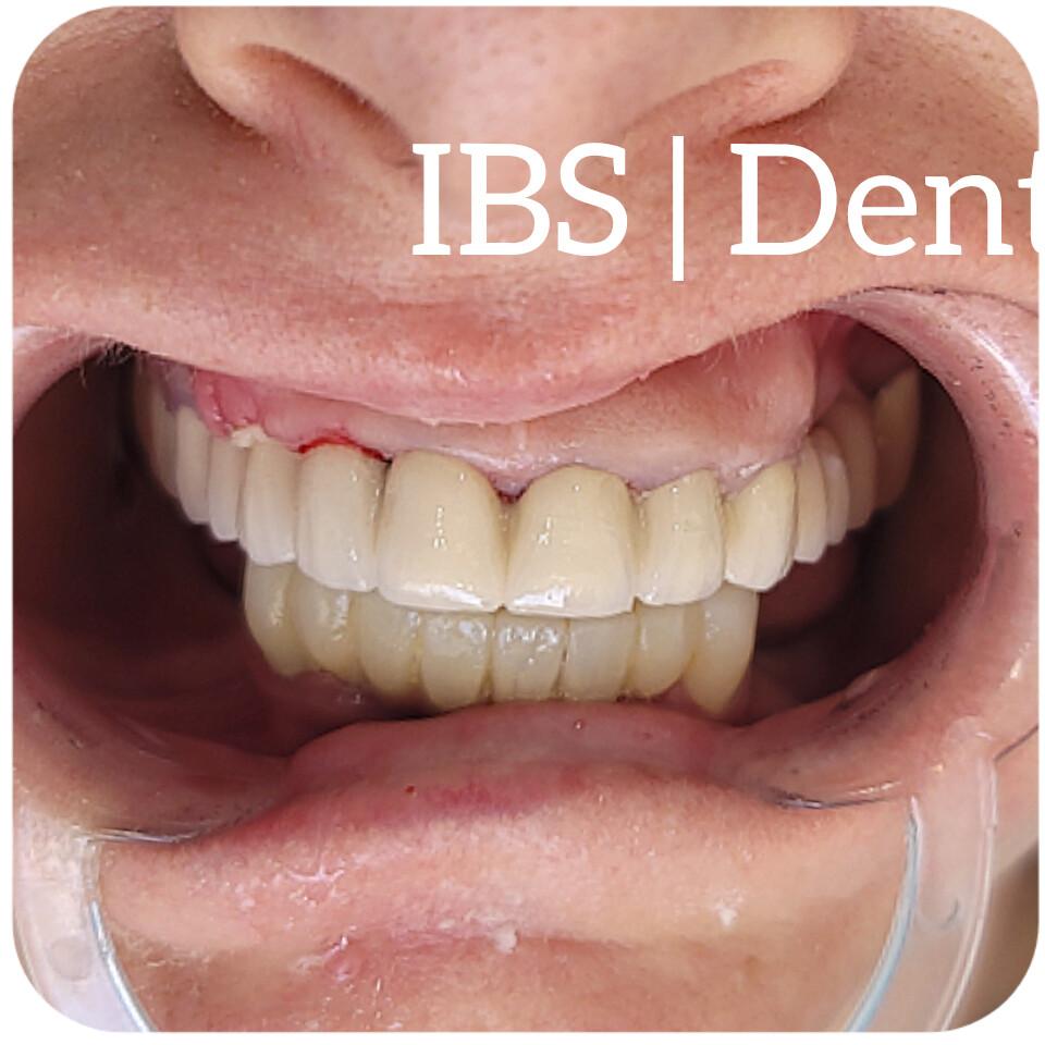 Dopo il Trattamento 6